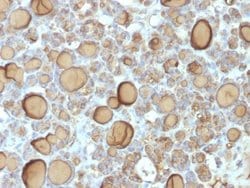 Thyroglobulin Antibody (TGB/1970R) - Azide and BSA Free, Novus Biologicals 100 &mu;g | Buy Online | Novus Biologicals | Fisher Scientific